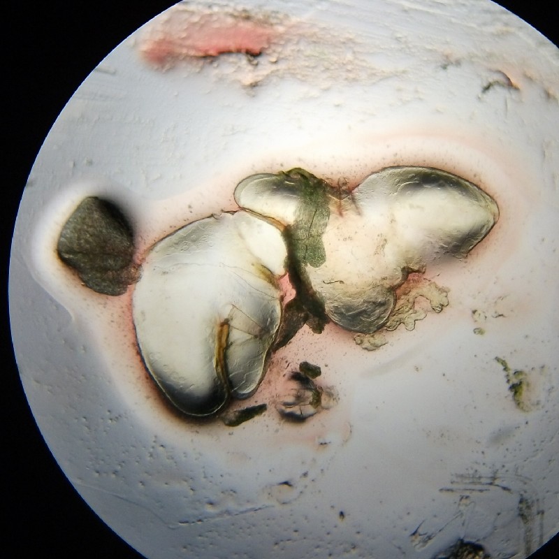 透明な2つの『だ腺(だ液腺)』の写真