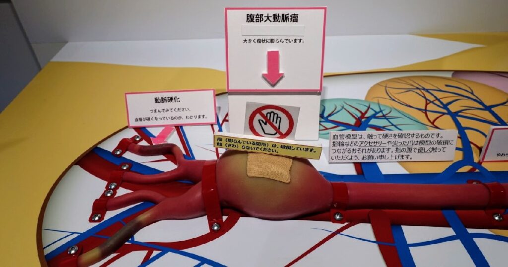 『動脈硬化』の状態を触って確認できる『血管模型』